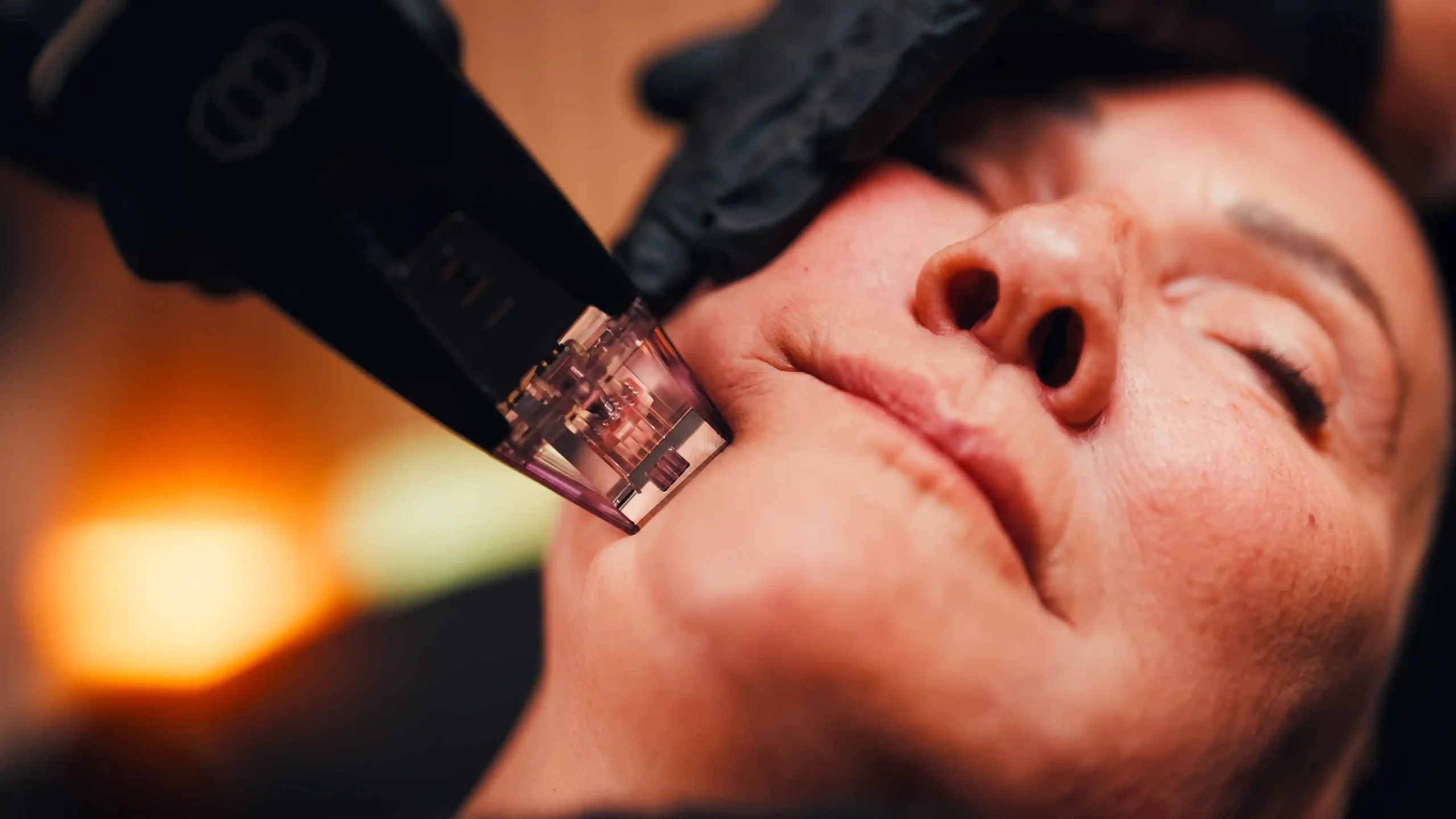 Precision aesthetic treatment equipment at Amer Clinic demonstrating medical excellence